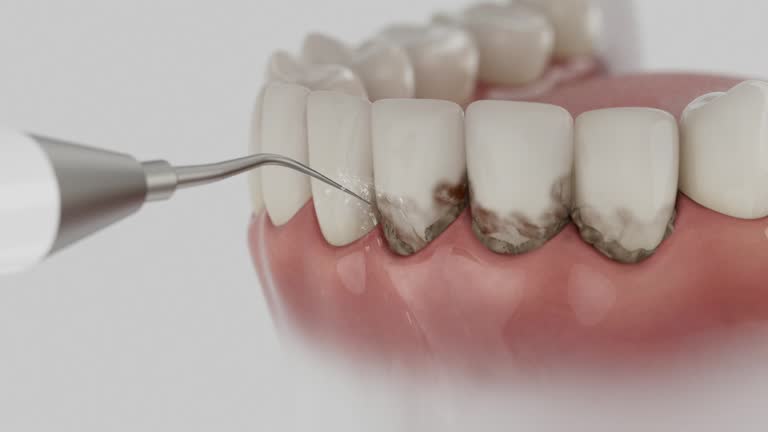 Reliable Dental contractor in Buhl, ID by Smile Center Dentistry